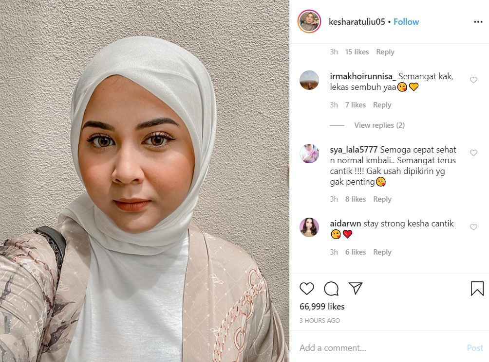 Divonis Sakit Tumor, Kesha Ratuliu Kini Panen Dukungan Bagikan Semangat