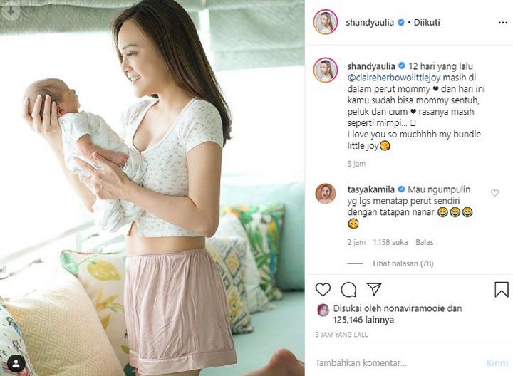 Shandy Aulia Punya Perut Rata Usai Melahirkan