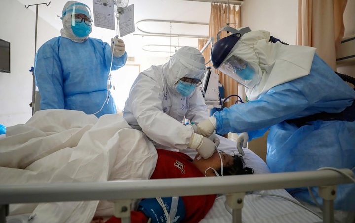 Bukan Corona Biasa, Kemenkes Duga WN Jepang Terinfeksi Virus Yang Sudah Bermutasi