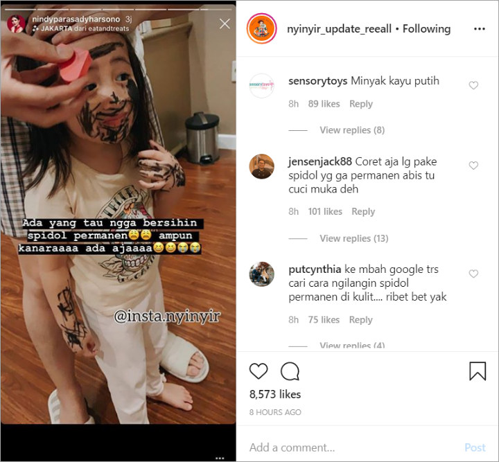 Nindy Bingung Cara Bersihkan Spidol Permanen Di Wajah Anaknya