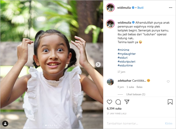 Widi Mulia Bersyukur Tak Lagi Dituding Permak Hidung Berkat Anak Kedua, Kok Bisa?