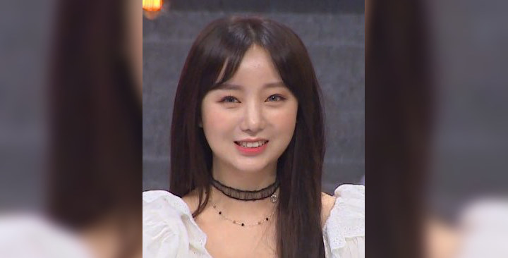 Bentuk Hidung Kei Lovelyz Di Bilang MemPrihatinkan, Di Sebut Gagal Operasi Plastik