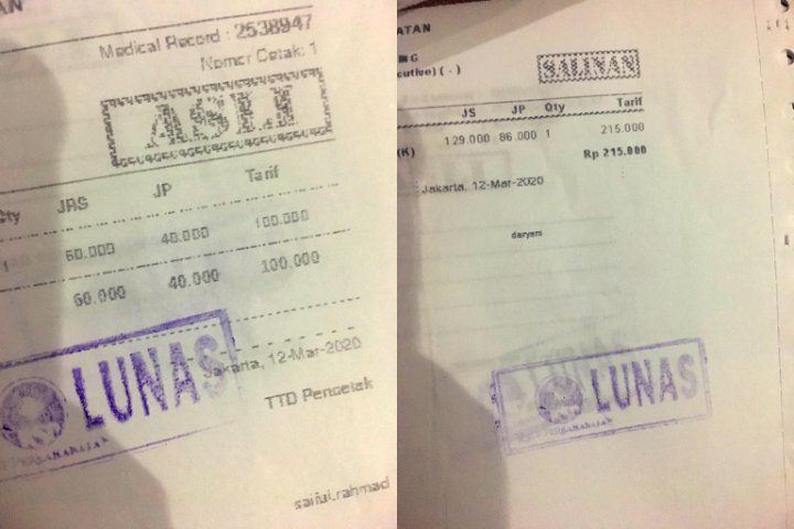 Tes Corona Mandiri di RSUP Persahabatan Berbayar Rp 700 Ribu