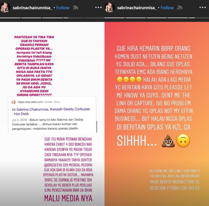 Sabrina Chairunnisa Geram Usai Dituding Lakukan Operasi Plastik, Ungkap Fakta Sebenarnya
