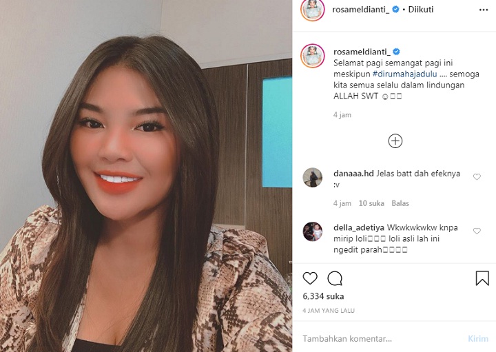 Rosa Meldianti Posting Foto Cantik Mirip Aurel Hermansyah, Netter Kompak Bilang Editan