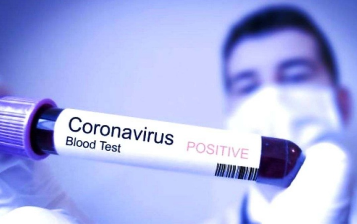Mutasi Virus Corona Bikin Banyak Orang Resah, Ini Kata Ahli