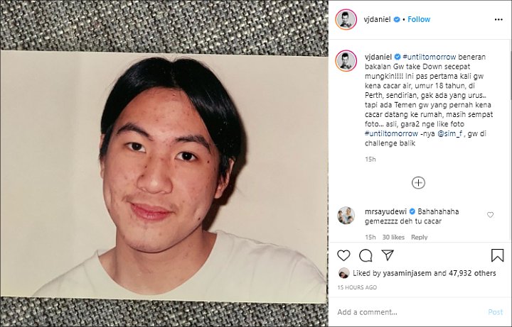 Ikutan Until Tomorrow Chalenge, Daniel Mananta Unggah Foto Jadul Kena Cacar