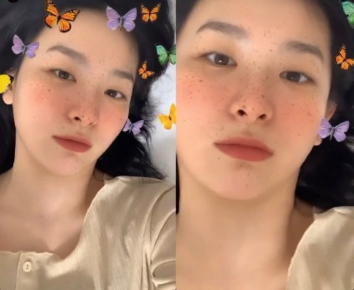 Seulgi Red Velvet Pamer Wajah Berbintik nya Di instalgram Tuai Komentar Kurang Enak