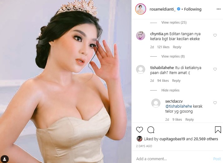 Rosa Meldianti Tampil Bak Ratu Kecantikan, Ketiak Hitam Jadi Sorotan