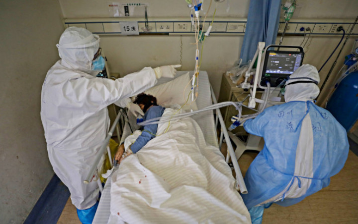 Warna Kulit 2 Dokter Wuhan Menghitam Usai Kritis Karena Covid-19, Ini Dugaan Penyebabnya