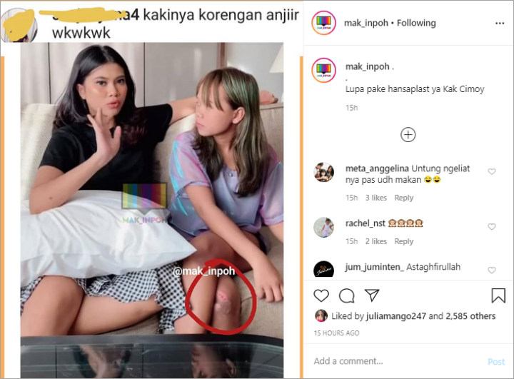 Cimoy Montok Asyik Ngobrol, Netizen Malah Salfok ke Lutut yang Disebut Korengan