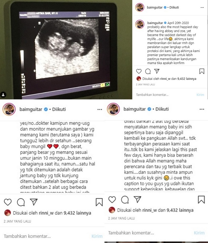 Kronologi Keguguran Artika Sari Devi