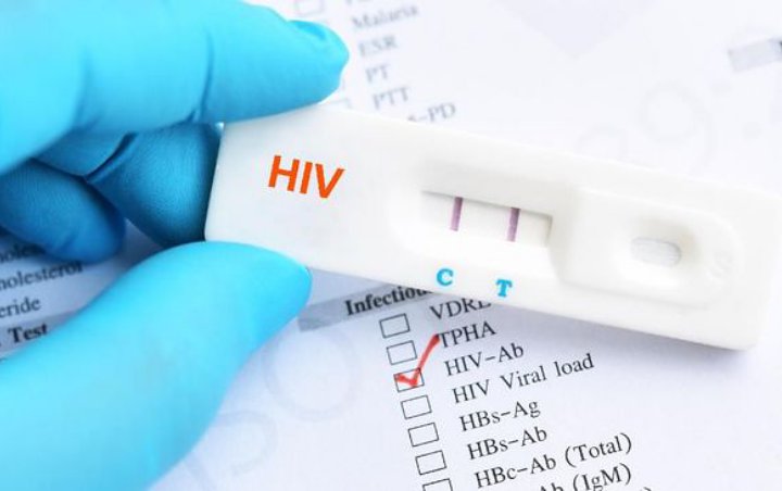 Bahaya Lockdown Kala Corona Tingkatkan Infeksi Kasus HIV, Kok Bisa?