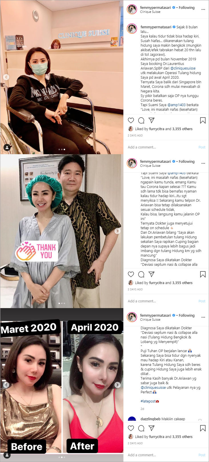 Mengeluh Susah Nafas, Femmy Permatasari Jalani Operasi Hidung di Tengah Corona