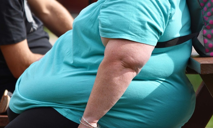 Obesitas