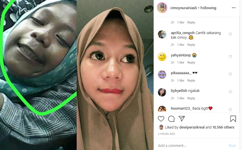 Cimoy Montok Akui Potret Dirinya Di Masa Lalu Jelek, Begini Perbandingannya