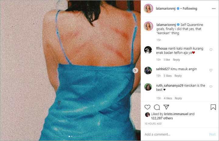 Seksinya Marion Jola Pamer Punggung Usai Kerokan, Netizen Langsung Riuh