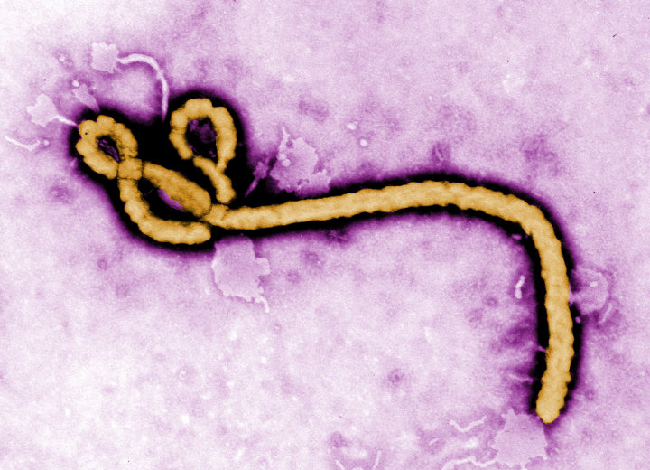 Virus Ebola