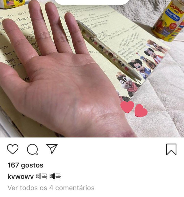 Mina Eks AOA Bikin Netizen Khawatir, Posting Foto Tangan Seolah Habis Dilukai Sendiri