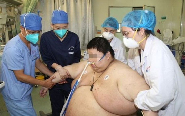 Viral Seorang Pria Berat Badannya Naik Hingga 279 Kilogram Usai 5 Bulan Lockdown di Wuhan