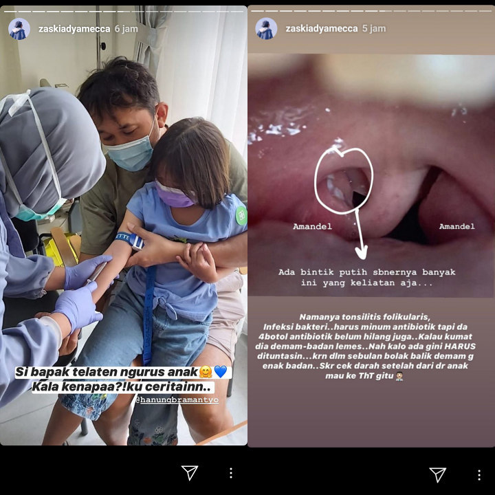 Putri Zaskia Adya Mecca Idap Tonsilitis Folikularis, Belum Sembuh Meski Habis 4 Botol Antibiotik