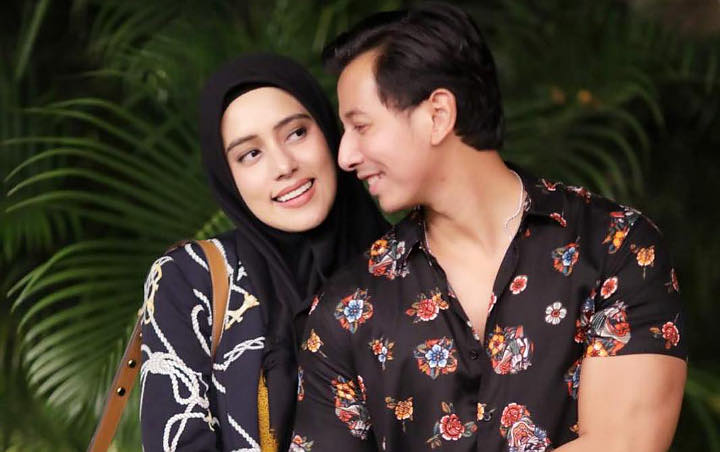 Sweet Banget, Sonny Septian Ngeluh Kesusahan Cium Fairuz Cuma Gara-Gara Ini