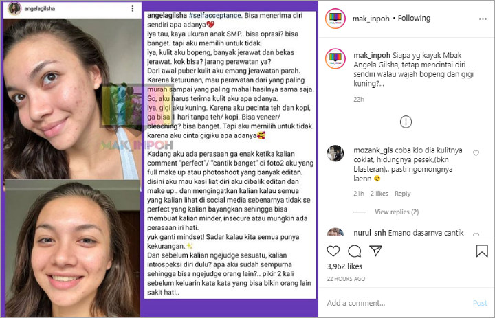 Postingan Angela Gilsha