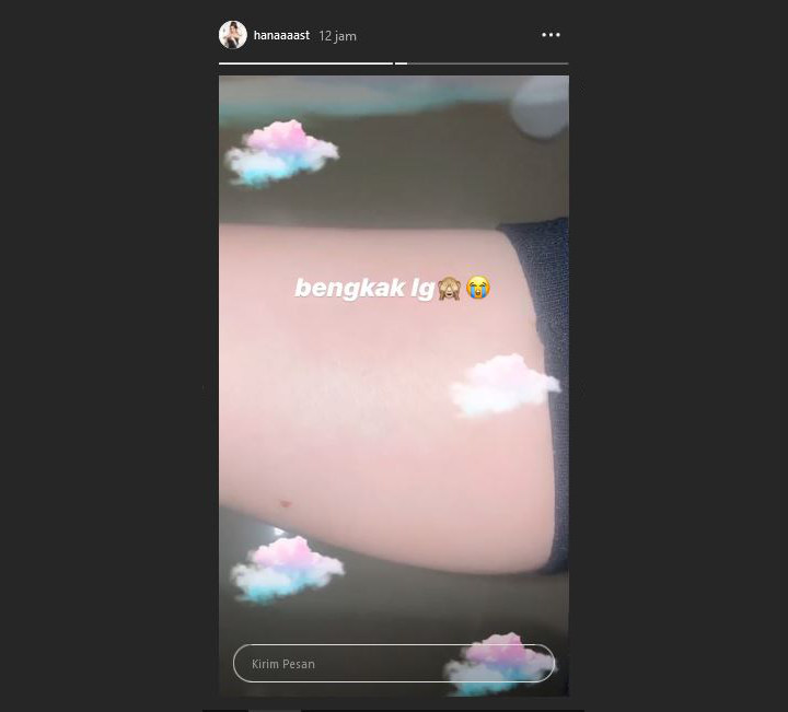 Hana Hanifah