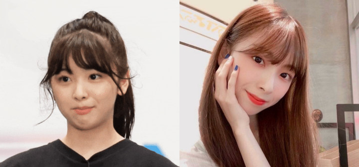 Netizen Korea Bandingkan Wajah Miihi NiziU Sebelum dan Sesudah Pakai Kawat Gigi
