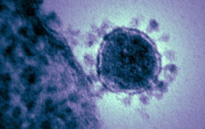 Ahli Di AS Nekat Ciptakan Virus Sejenis Corona Dan ‘Sebarkan’ Ke Sejumlah Negara, Kenapa?