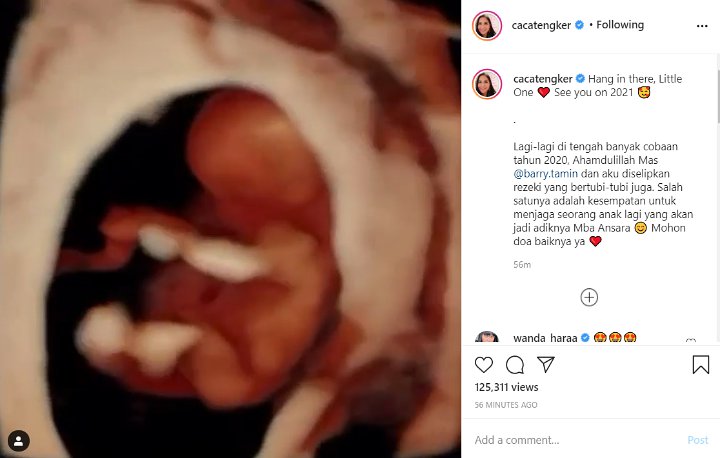 Caca Tengker Umumkan Hamil Anak Kedua