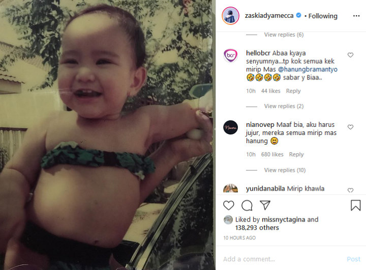 Zaskia Pamer Foto Masa Kecil Uji Kemiripan Sama Anak, Kalah Telak dengan Hanung Bramantyo