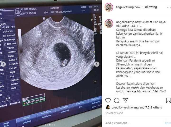 Angelica Simperler Hamil Anak Pertama