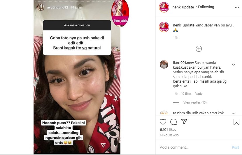 Diledek Sering Edit Foto, Ayu Ting Ting Ngegas Malah Banjir Pujian Saat Buktikan Ini