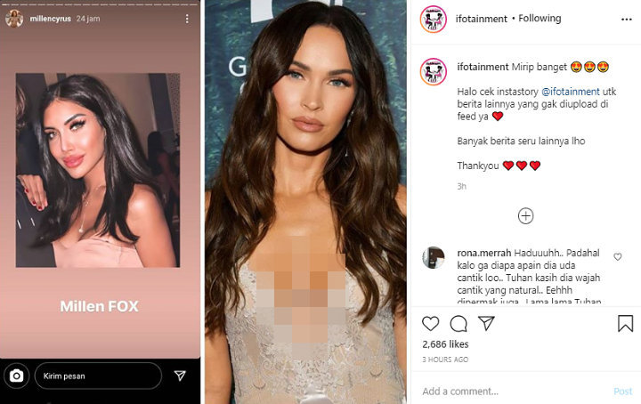 Wajah Millendaru Usai Filler Bibir Disandingkan Dengan Megan Fox, Mirip?