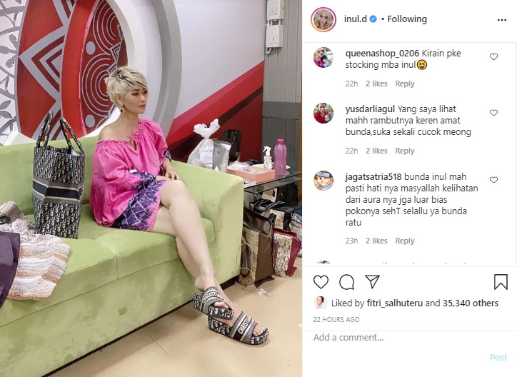 Inul Daratista Tunjukan Warna Kulit Wajah Dan Kaki Yang Begitu Berbeda Malah Banjir Pujian, Kok Bisa?