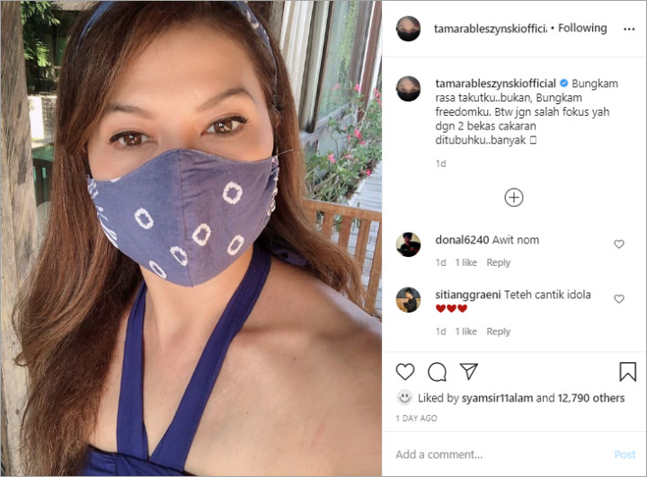 Tamara Bleszynski Pede Pamer Bekas Cakaran di Tubuhnya, Netter Malah Fokus yang Lain