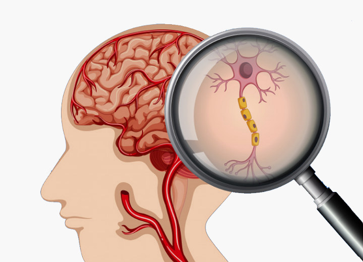 Menjaga Kesehatan Otak, Saraf, dan Fungsi Organ
