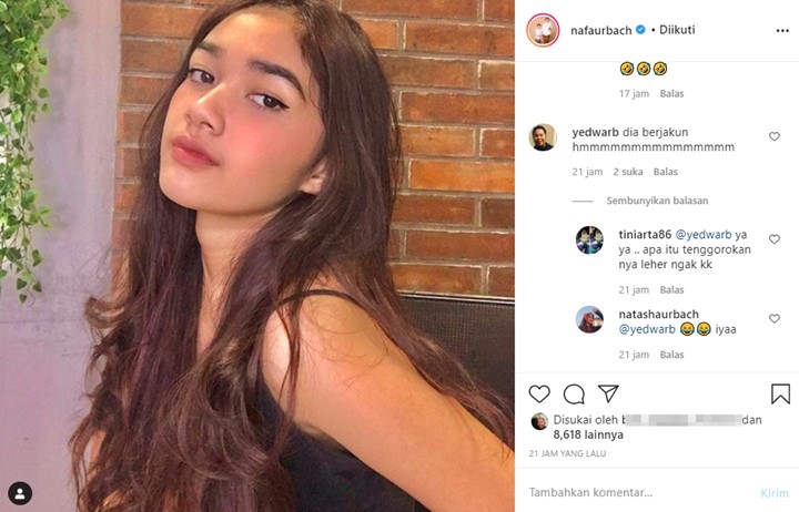 Nafa Urbach Bagikan Foto Keponakan Cantik, Leher Timbul \'Jakun\' Jadi Sorotan