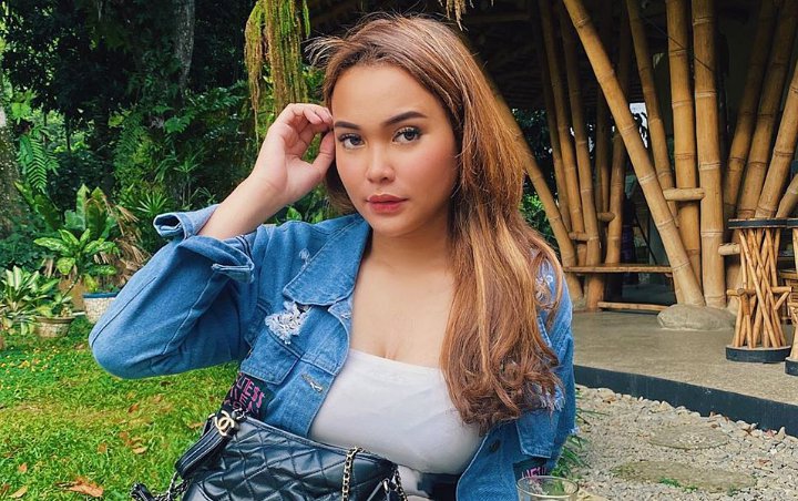 Biasa Dibully, Dinda Shafay Kecam Prank Wajah 'Bopeng' Jerawatan Justru Banjir Ucapan Terima Kasih