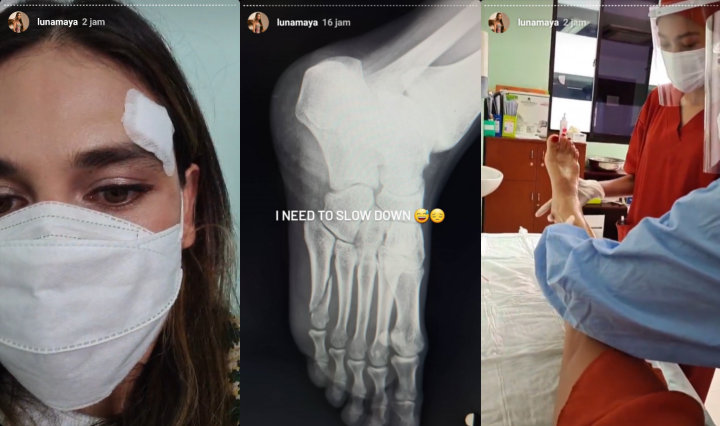 Ari Lasso Doakan Luna Maya Agar Cepat Sembuh, Alami Patah Tulang?