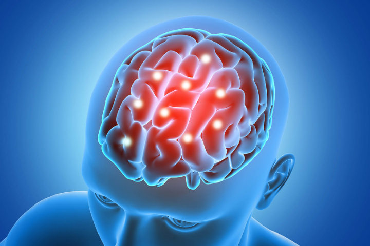 Meningitis