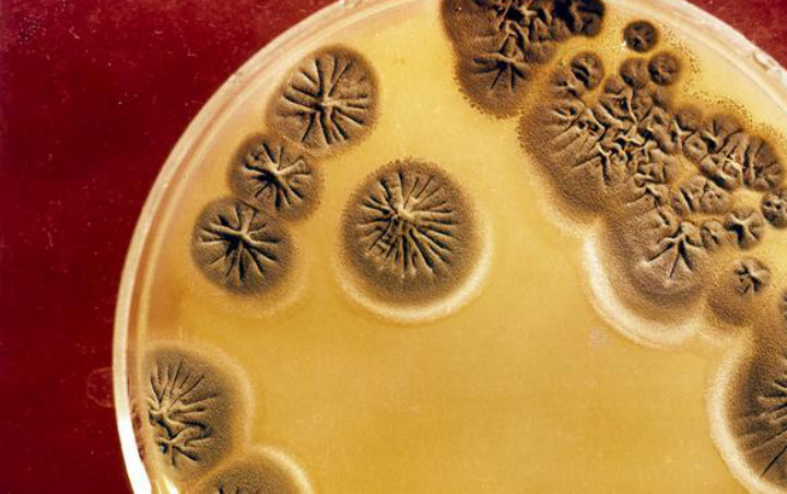 Jauh Lebih Bahaya Ketimbang COVID-19, Bakteri Super Ini Jadi Ancaman Dunia Kesehatan Modern