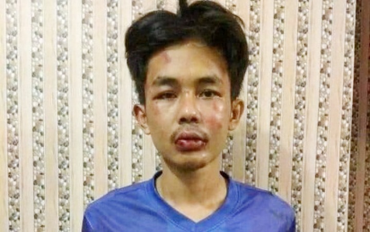 Penusuk Syekh Ali Jaber Disebut Gangguan Jiwa Polda Penusuk Syekh Ali Jaber Disebut Gangguan Jiwa Polda