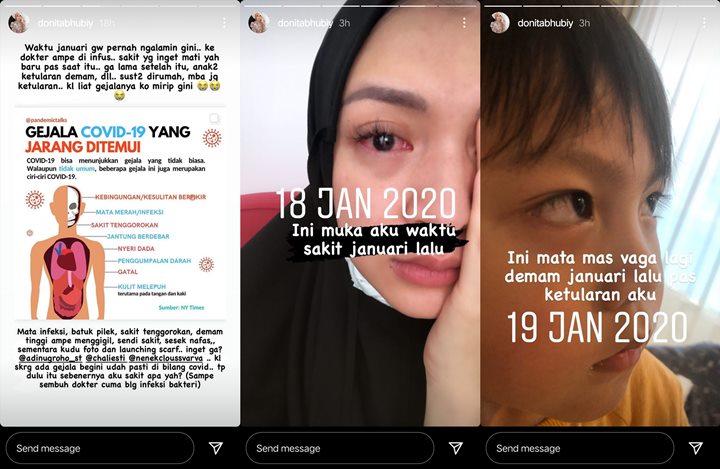 Donita Alami Demam Tinggi Sampai Susah Napas Mirip Gejala COVID-19: Mau Mati Rasanya