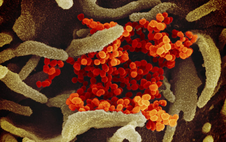 Teori Baru Ungkap Asal Usul Virus Corona Yang Masih Jadi Misteri