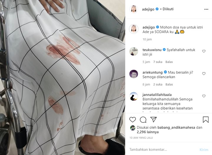 Ade Jigo Minta Doa untuk Istri, Bagikan Foto Kain dengan Bercak Darah