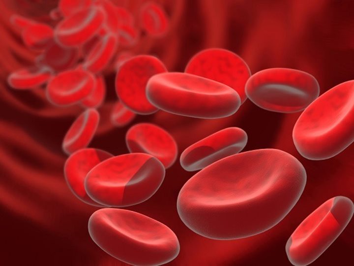 Mengalami Anemia Tanpa Sebab