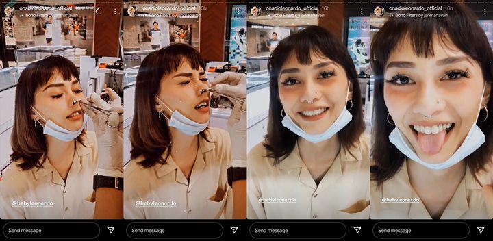 Istri Onadio Leonardo Bagikan Momen Saat Tindik Hidung, Asli Bikin Ngilu