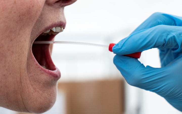 Standar Harga Swab Test Corona Akan Ditentukan, Ini Prediksi Biayanya